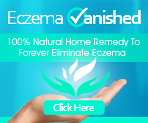 Eczema Vanished